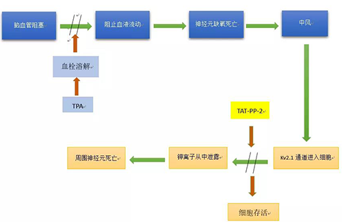 脑卒中形成机制