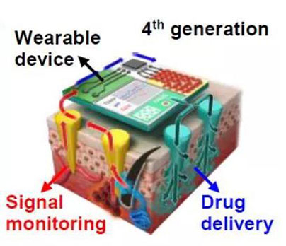 第四代透皮给药技术：在可穿戴设备的帮助下，用于患者定制治疗.jpg