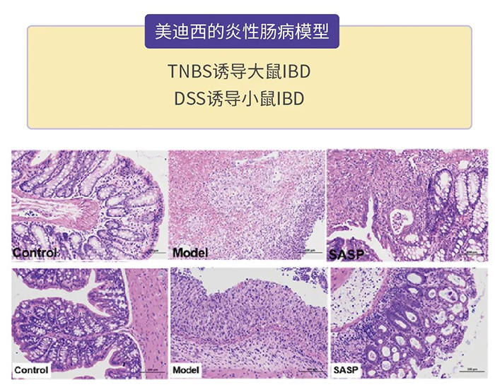 AG真人国际的炎性肠病模型.png